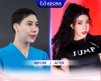 Hot Tiktoker Huỳnh My tại ADONA