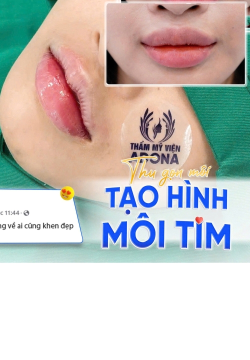 Tạo hình môi trái tim tại TP.HCM